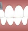 Emergency Dentist Houston - Houston,TX,USA Directory Listing